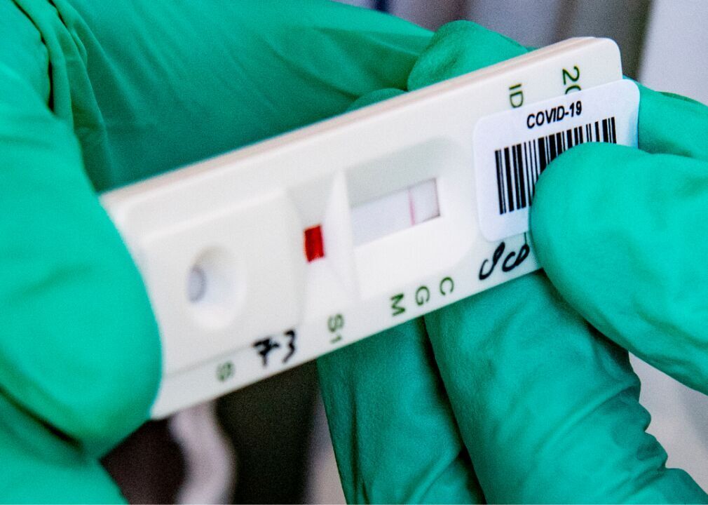 Antibody test reliability